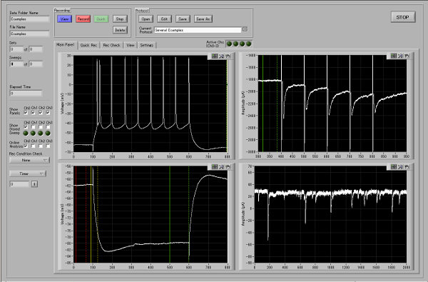 Example of Electrophysiological Measurement Software